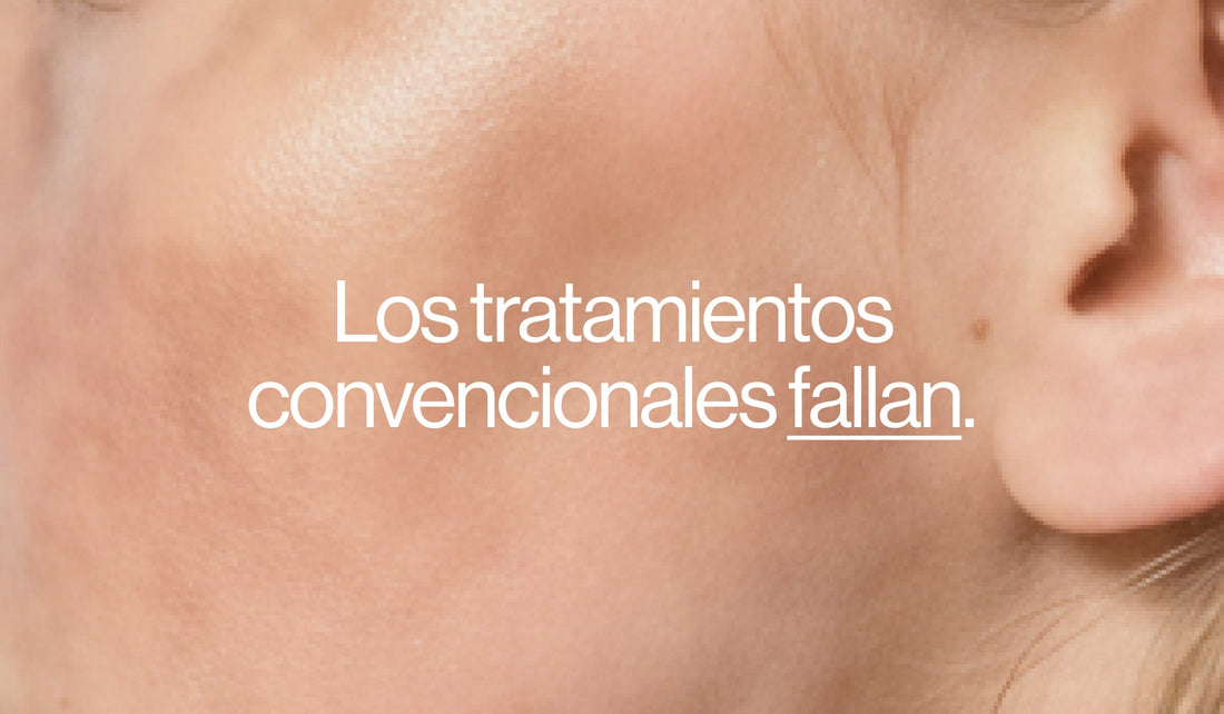 ¿Tenés manchas y probaste todo? Por qué el láser no siempre es la solución