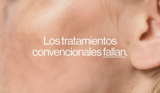 ¿Tenés manchas y probaste todo? Por qué el láser no siempre es la solución