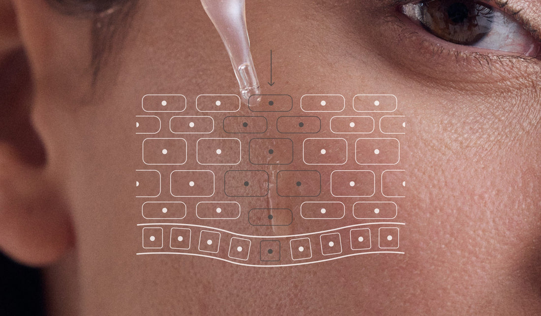 Melasma: cómo tratarlo.