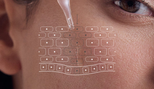 Melasma: cómo tratarlo.